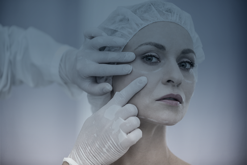 Blefaroplastia